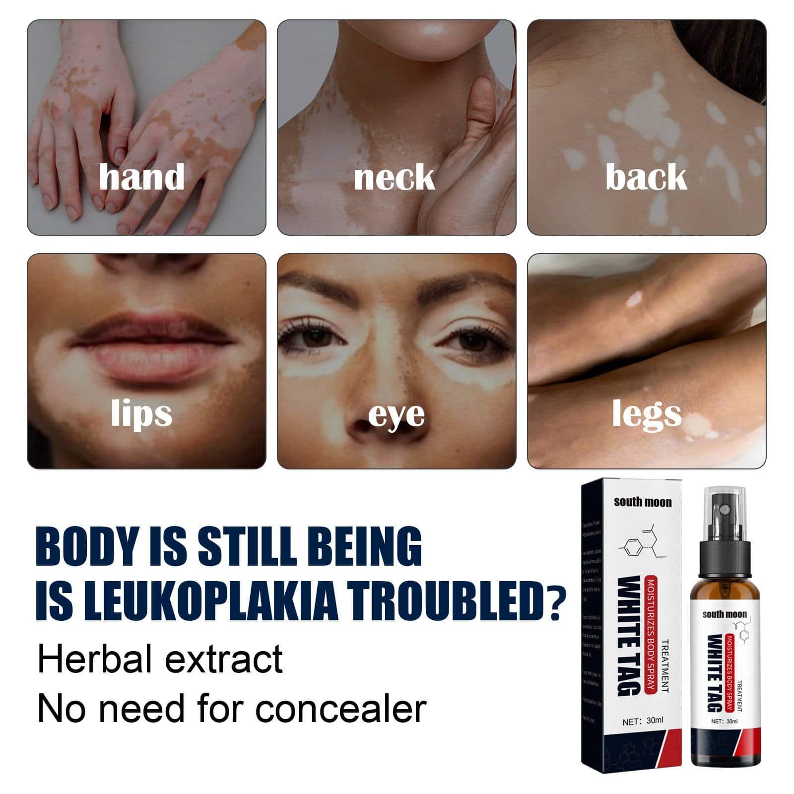 South Moon White Tag Removal Spray