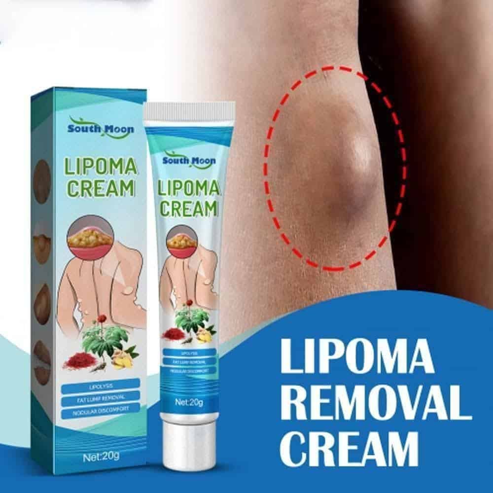 Lipoma Removal Cream - Image 2