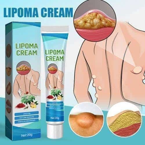 Lipoma Removal Cream