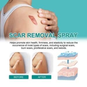 South Moon Scar Removal Spray
