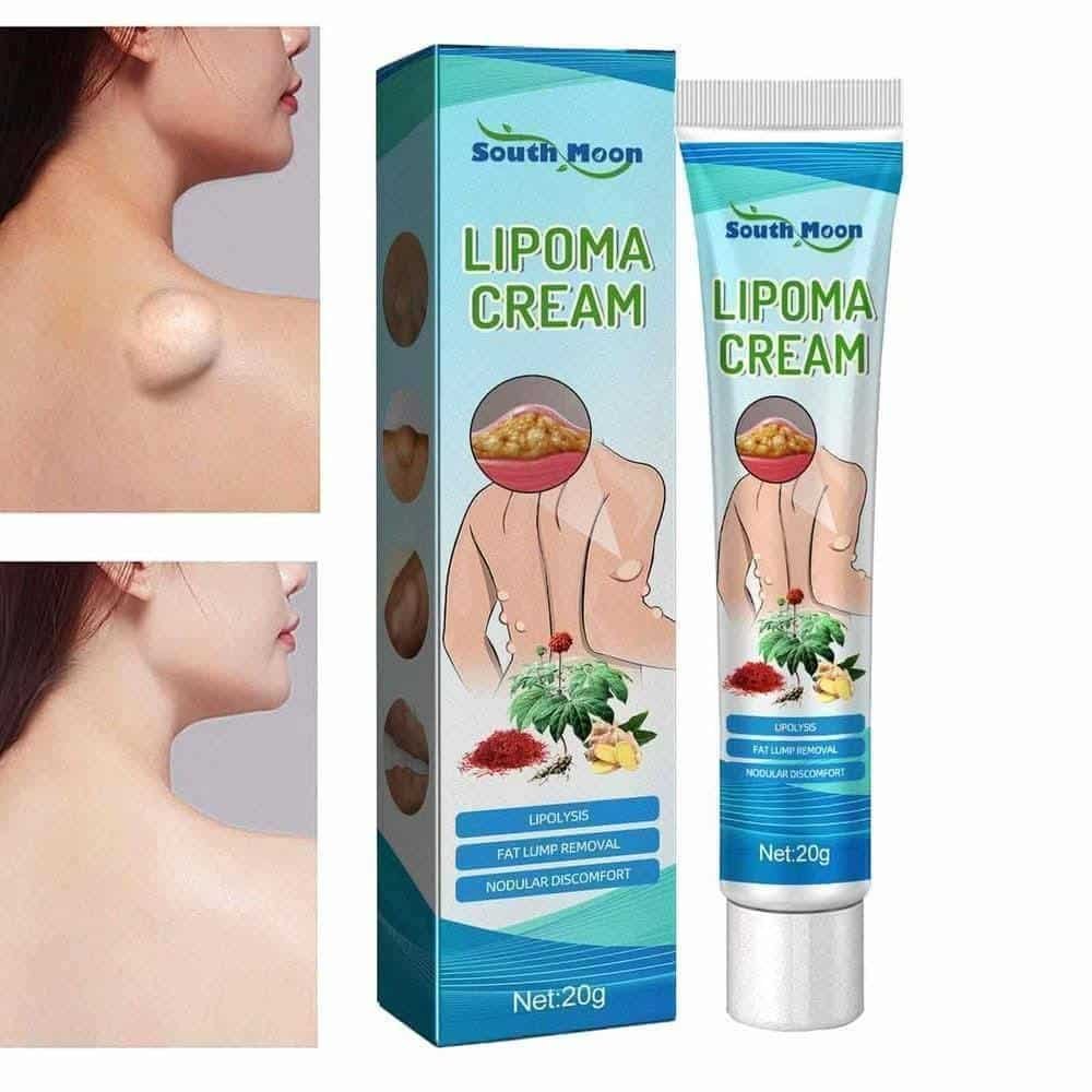 Lipoma Removal Cream - Image 3