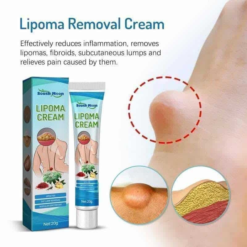 Lipoma Removal Cream - Image 4