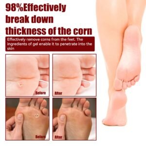 South Moon Foot Corn Removal Extra Strength Gel